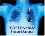 FanSpurs